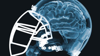 NFL Gets Brained By Its Own Study